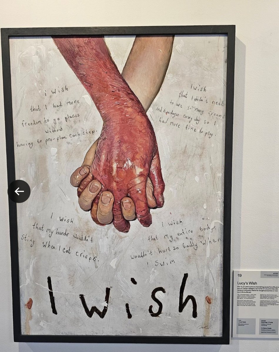 'I WISH' Lucy's vision for a painting portraying life with #harlequins #ichthyosis is a stunning blend of science and art. This #PPI masterpiece sheds light on the challenges of #RareDisease. Proud to see it take 1st prize at a UK exhibition! #ScienceMeetsArt @cpcconf2024 🎨👏