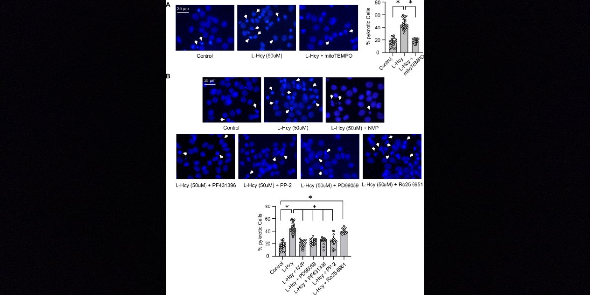 New in JBC press: 'Homocysteine-induced sustained GluN2A NMDA receptor stimulation leads to mitochondrial ROS generation and neurotoxicity.' Learn more: jbc.org/article/S0021-…