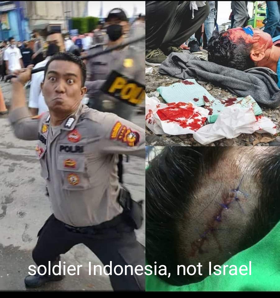 NabiWafayee's tweet photo. #HelpRefugees_Indonesia
Indonesia sheds crocodile tears for Palestine while receiving money from the Australian government to torture and gradually killing refugees. @hrw @amnesty @IntlCrimCourt @WgarNews @PplJustLikeUs @volker_turk @smh @guardian @GillianTriggs @CNN @POTUS @UN https://t.co/SQ4QhX8qKX
