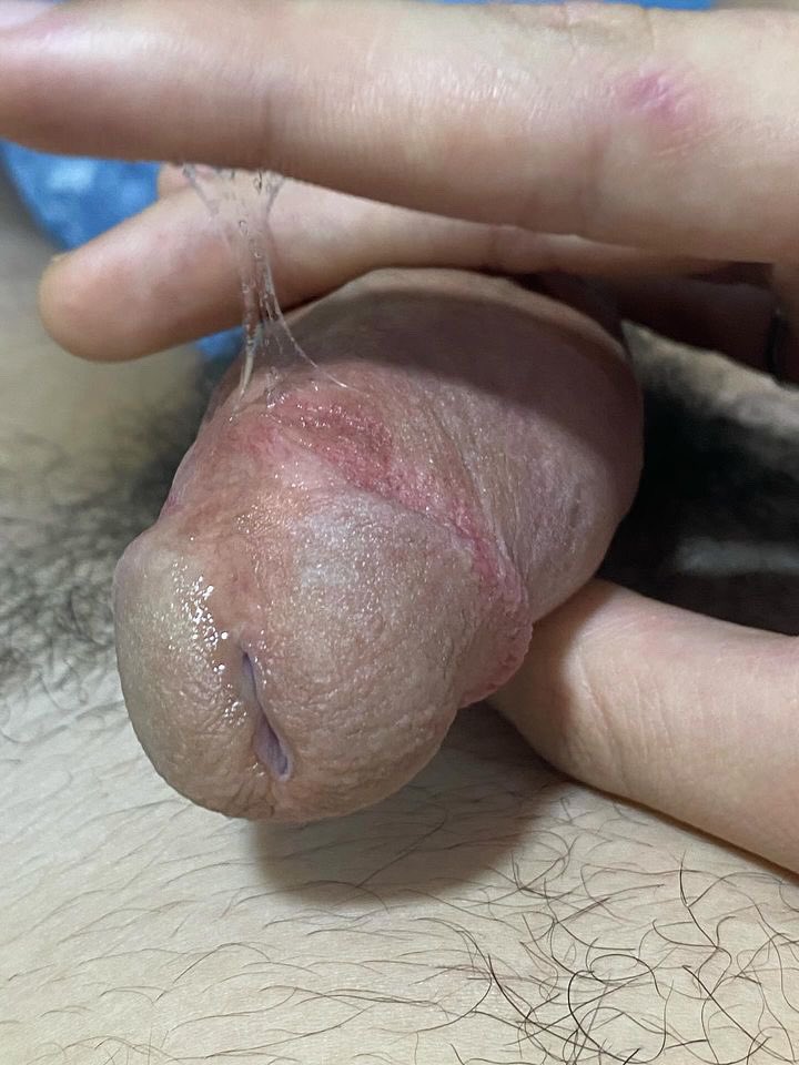 Nasse_18's tweet photo. Who will help me with my 🍆🍆 https://t.co/TUkQnebA13
