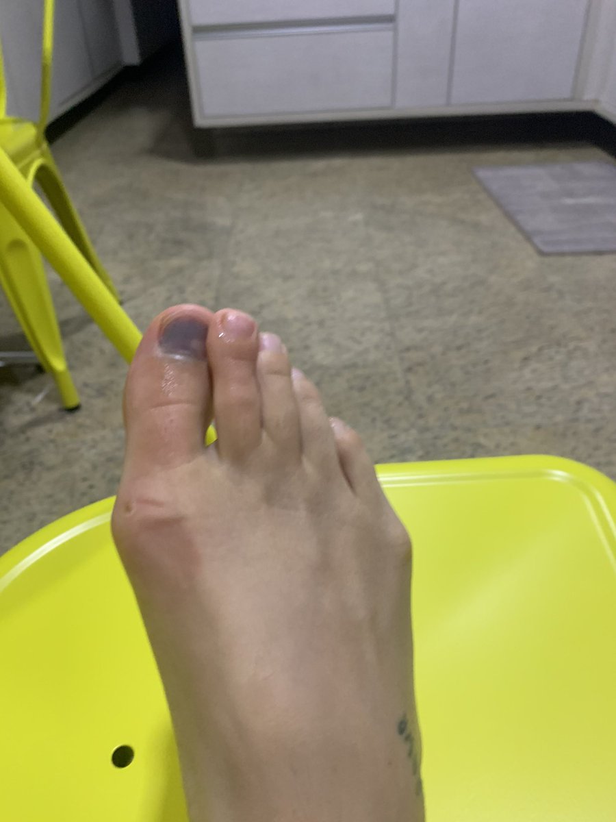 bncdrd's tweet image. Pois eu deixei cair um pior, mas salvei com meu dedão 🙏