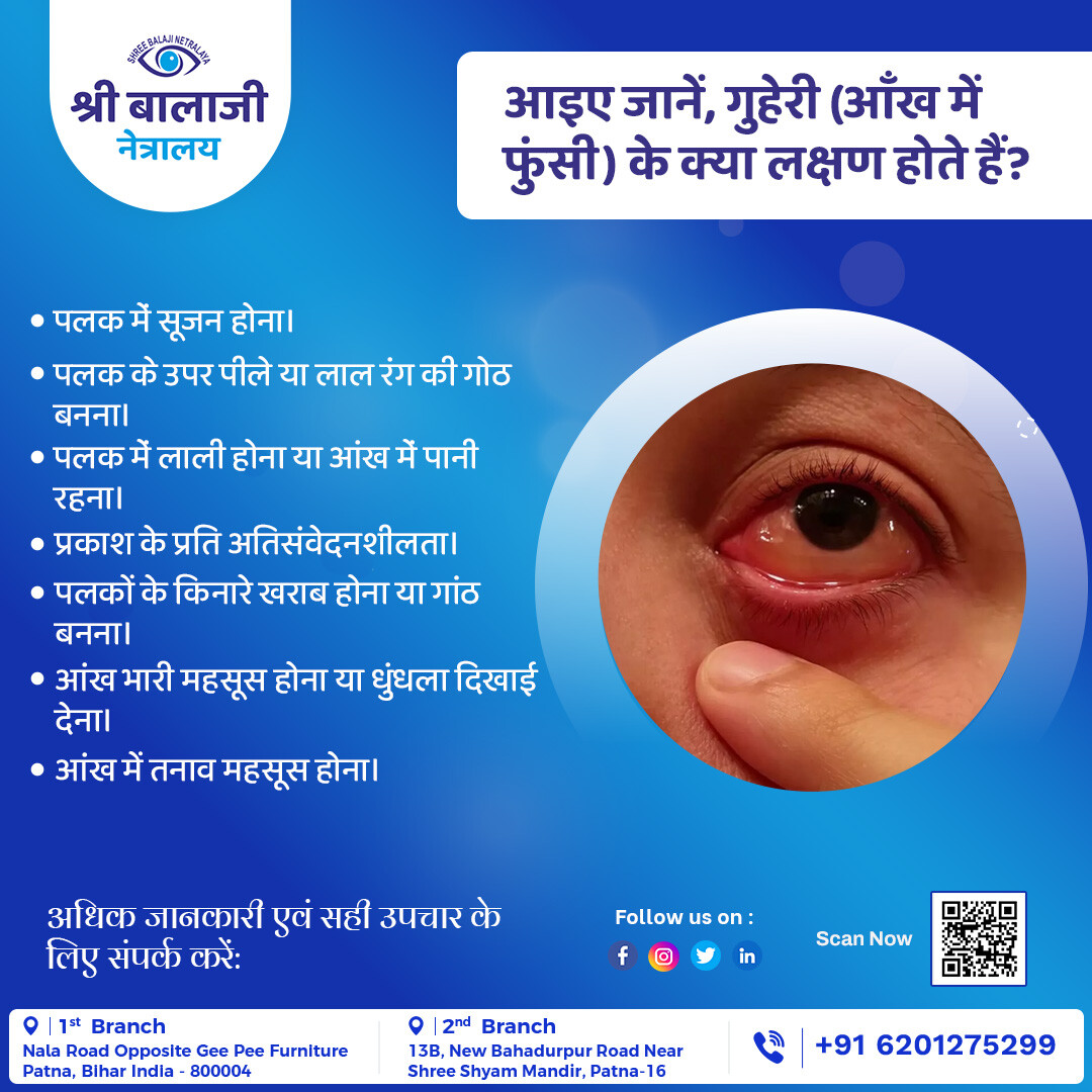 जानें, गुहेरी (आँख में फुंसी) के क्या लक्षण होते हैं?
#eyehealth #eyesurgery #eyedoctor #shreebalajinetralaya #visioncare #eyesight #shreebalaji #Advancedtechnology #YourVisionOurPriority #BookNow #Healthyeyes #bihar #patna #seetheworldagain #patnajunction #patnagarh #Biharboard