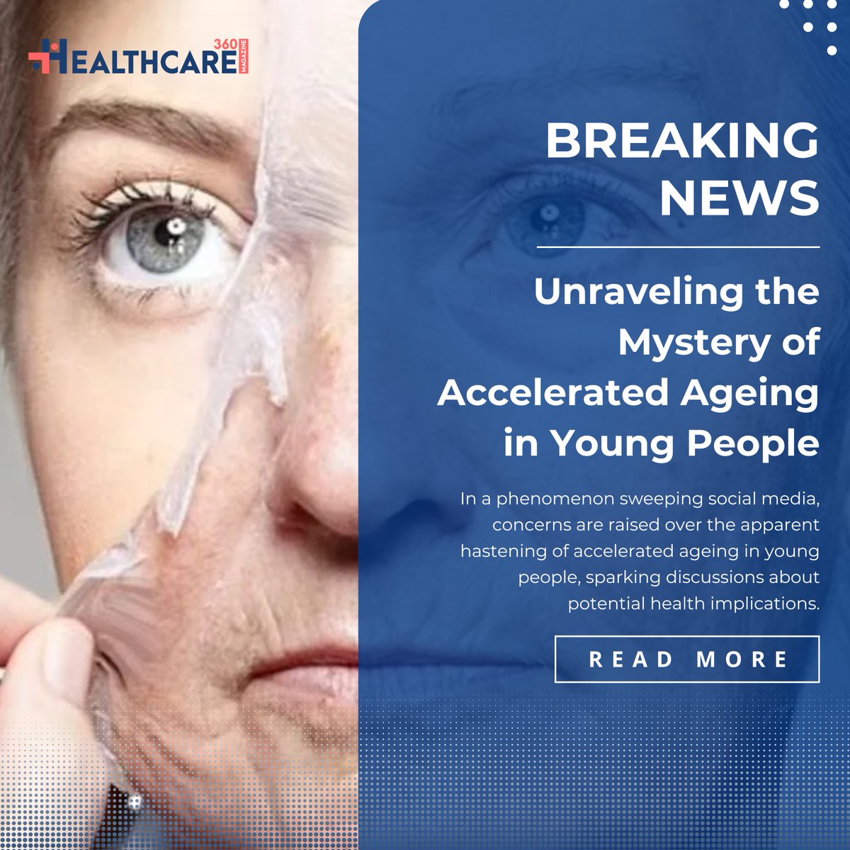 Unlocking the Mystery of Accelerated Ageing in Youth: Dive into the intriguing insights on why young people are ageing faster and the concerning health implications. 

Read More: healthcare360magazine.com/accelerated-ag…

 #AcceleratedAgeing #YouthHealth #CancerRisk #DietAndHealth #GenerationZ