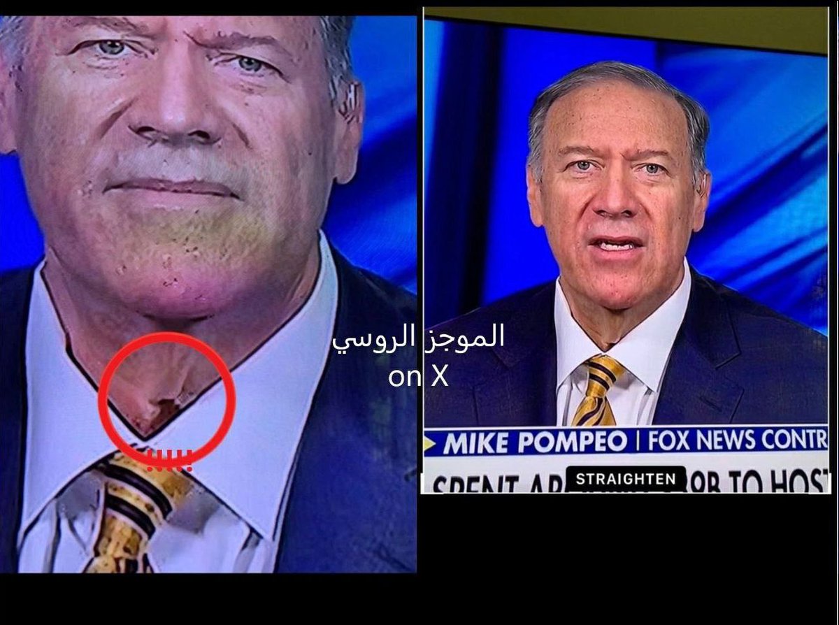 🚨‼️🇺🇸 Mike Pompeo forgot to adjust his human face mask before the interview, an honest mistake.