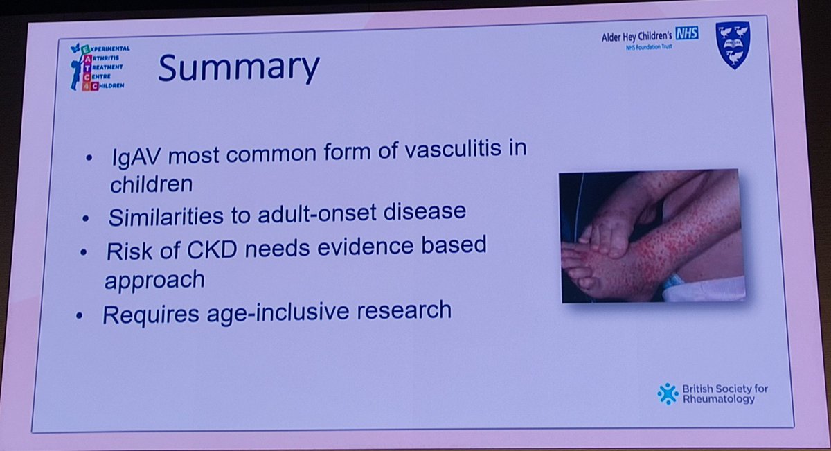 Thank you @louise_oni for a fabulous presentation! Your passion about your young patients always touches my heart! #vasculitis SIG #BSR24 @ukivas @_ERNRITA @vascuk @IrishVasculitis @LauraWhitty5