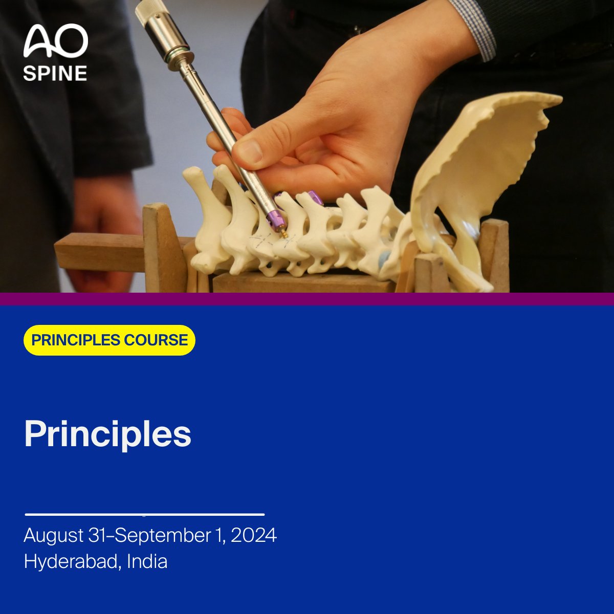 AO Spine Course—Principles Chairperson: Surya Prakash Voleti 🗓 August 31–September 1, 2024 📍 Hyderabad, India Register now - brnw.ch/21wJcpO