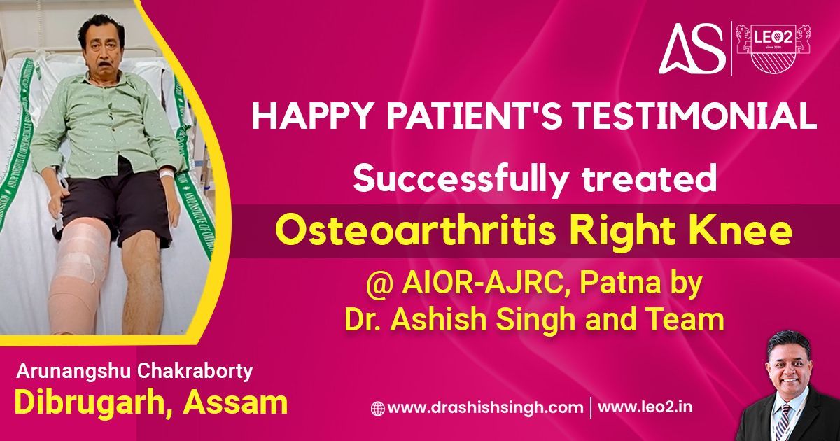 A Patient From Dibrugarh, Assam successfully treated Osteoarthritis Right Knee at @AIOR-AJRC by Dr. Ashish Singh and Team. Watch Full Video:- youtu.be/qpYH3-xgKNg Book an Appointment with the Internationally Acclaimed Orthopedic Surgeon Dr. Ashish Singh: +91 8448441016