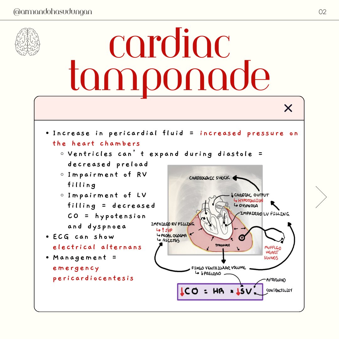 Cardiac tamponade is a life-threatening condition characterised by accumulation of fluid in the pericardial space. It typically presents with Beck's triad.

Watch the full video here: youtu.be/9FgpLaCi_KE?fe…
.
.
.
#Armando #cardiactamponde #heart #beckstriad
