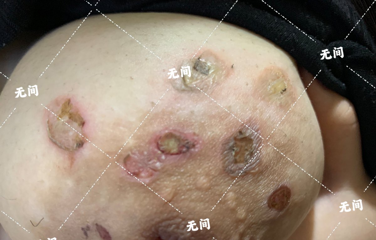 #烟烫 #烟疤 #灭烟 #男s女m #刑主 #刑奴 自己的图从今天开始还是加个水印吧，我最喜欢的灭烟。