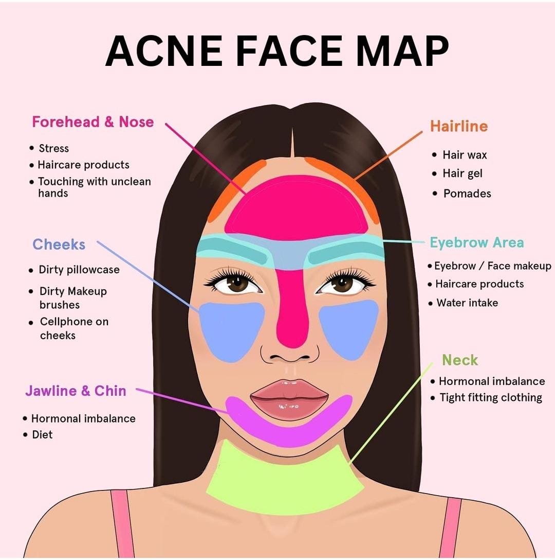 AcneFaceMap
✅Follow for more tips
✅like
✅comment
✅share
#beauty #beautytips #acne #acnefacemap  #acnefree #causeofacne #cleanandclearskin #healthyskin #ShareThisPost #virals