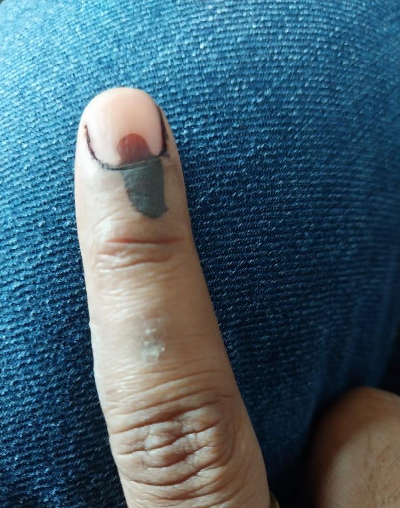 Manoj Chokhande tweet media