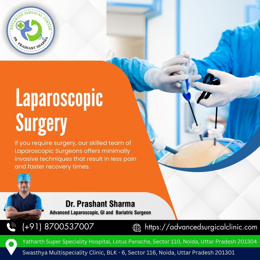 𝑳𝒂𝒑𝒂𝒓𝒐𝒔𝒄𝒐𝒑𝒊𝒄 𝑺𝒖𝒓𝒈𝒆𝒓𝒚
If you require surgery, our skilled team of Laparoscopic Surgeons offers minimally invasive techniques that result in less pain and faster recovery times.
..
.
Book your appointment@ (+91)8700537007
.
#DrPrashantSharma #gallstones #Hernia