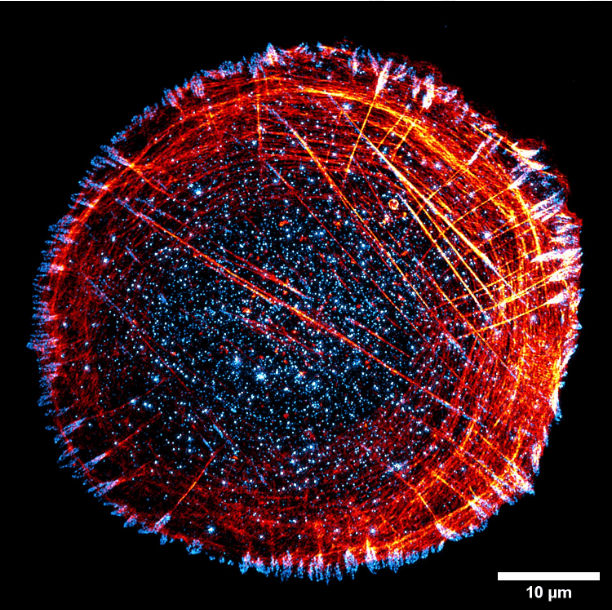 focalplane_jcs's tweet photo. Our ‘Featured image’ this week was acquired by @sujanghm from @guijacquemet's lab. It shows a U2OS cell stained for paxillin (cyan hot) and actin (red hot). You can read more about the image and Sujan’s research in our blog post: https://t.co/cfjYRODfuu https://t.co/3lXW0xcxJp