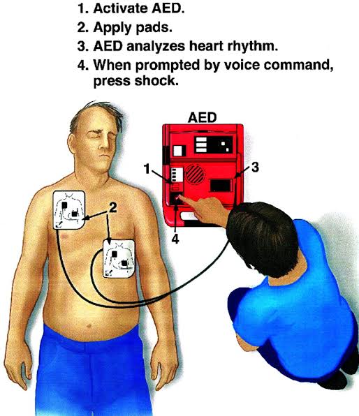 STEPS TO USE AED