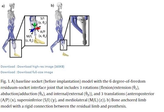 #Newpub in @JBiomech by @CUPhysMed faculty member Dr. Cory Christiansen & team on The #biomechanical influence of transtibial Bone-Anchored limbs during walking. pubmed.ncbi.nlm.nih.gov/38636112/