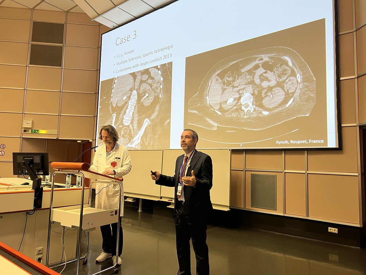 Central European Meeting (#CEM24). @evanliats discusses complications during stone section🙈. What would you do if you couldn’t remove your rigid ureteroscope from the ureter? @endouro @mario_sofer @vdconinck @thomastailly @OJWiseman @GuidoGiusti @OTRAXER