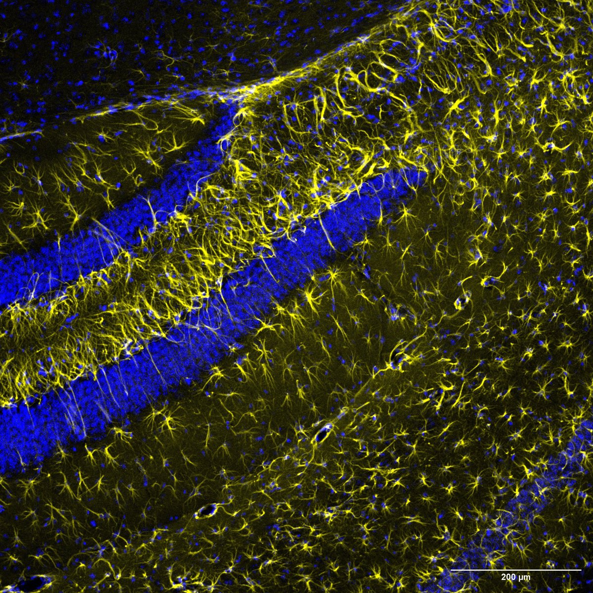 Unhappy hippocampal astrocytes

🟡GFAP 🔵HOECHST
 
#FluorescenceFriday #Neuroscience #Astrocytes #Microscopy #Leica @DCUResearchNano