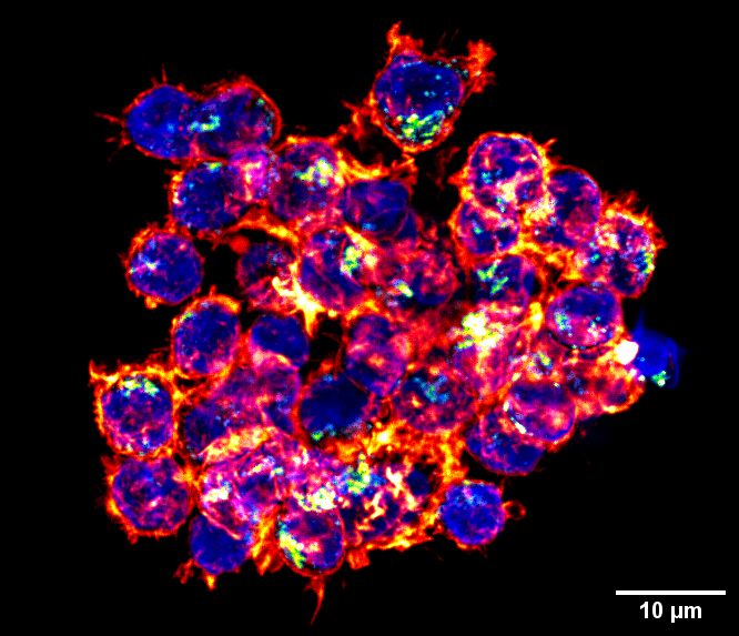 amnamusic22's tweet photo. Just some B-cell lymphoma cells socializing and getting into Friday vibes: in 2D and 3D 

Lysosomes in green, Actin in Red Hot &amp; DAPI
#Bcells #fluorescencefriday https://t.co/lruGGrBuPa