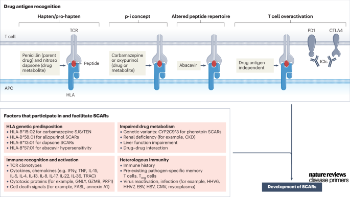 There are four proposed models for initiating T-cell recognition and activation in severe cutaneous adverse reactions: The “hapten/prohapten” theory, the “p-i” concept, the “altered peptide repertoire” model and “T-cell overactivation”. go.nature.com/3Qkfw9Q