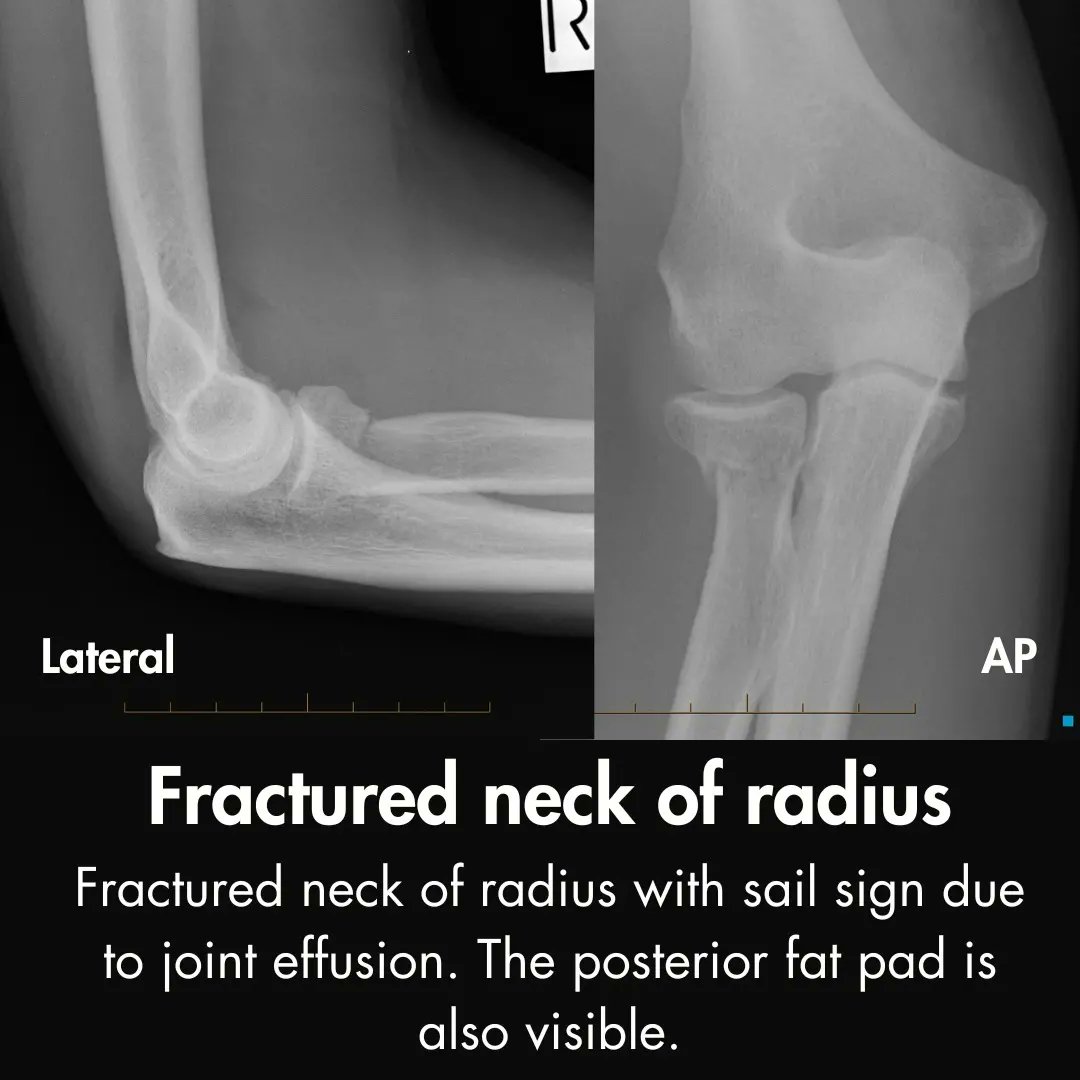 Ortho_Tutorials tweet picture