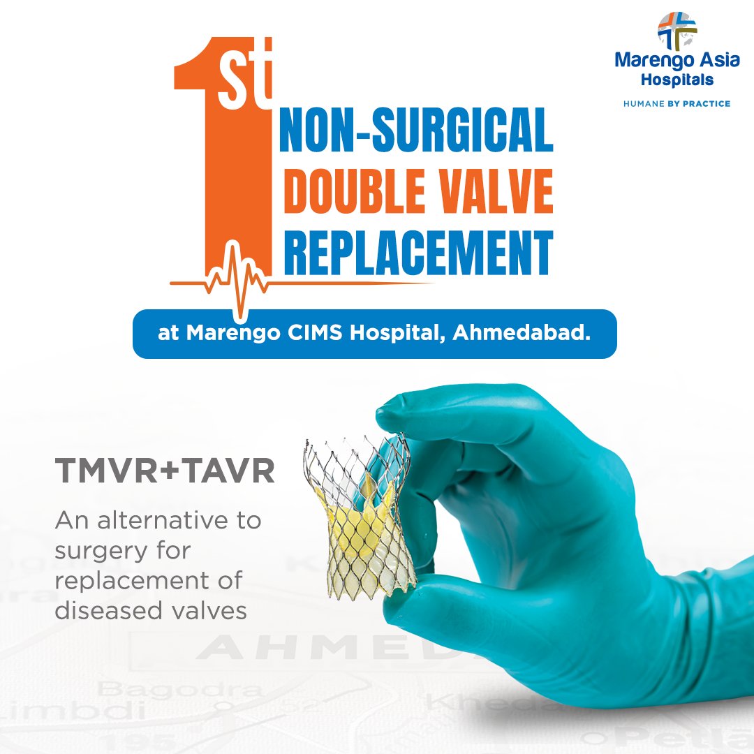 Gujarat witnesses its 1st Non-Surgical Double Valve Replacement - TMVR + TAVR- performed on a 77-year old woman. 
This approach eliminated the risks involved with traditional surgery, and offered safety, shorter hospital stay & quick recovery. 

#MarengoCIMSHospital #PatientFirst