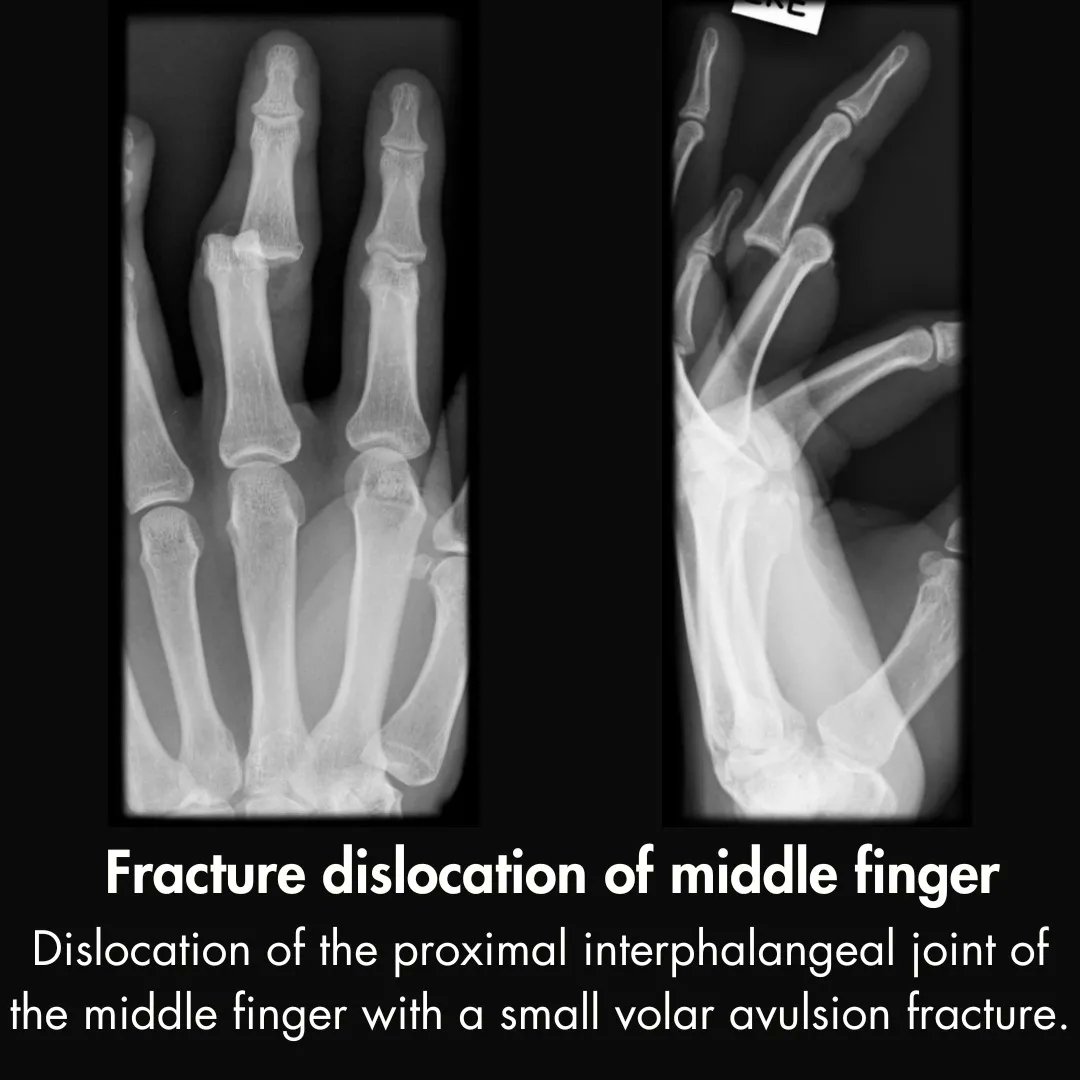 Ortho_Tutorials tweet picture