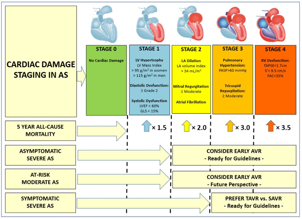 Cardiac damage staging in aortic stenosis is ready for prime time. Excellent Editorial by @PPibarot. sciencedirect.com/science/articl… @masaaki0825 @DaijiroTomii @FabienPraz