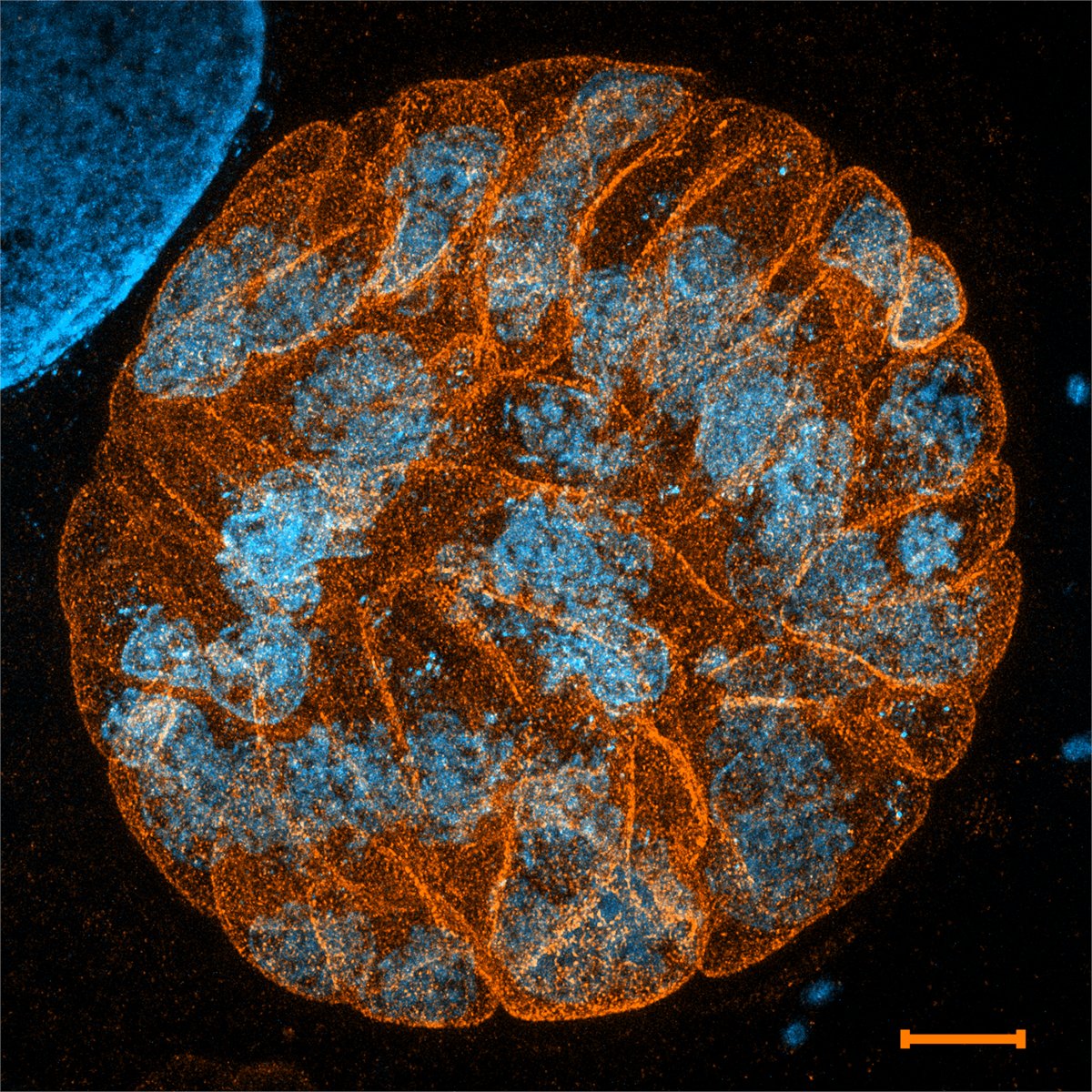 Yay! Our preprint on affordable super-resolution tool for #Toxoplasma chronic stage is out! Leveraging #ExM to explore cysts wasn't easy, and I'm excited about the possibilities this opens up for Toxo parasitologists. @jo_c_young lab biorxiv.org/content/10.110… #Microscopy #Science