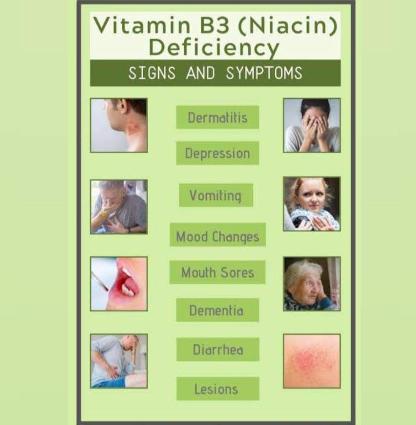 Vitamin B3 eksikliğinin bulguları Dermatit-depresyon-kusma- bilinç değişikliği-ağız yarası- demans-ishal-cilt lezyonları