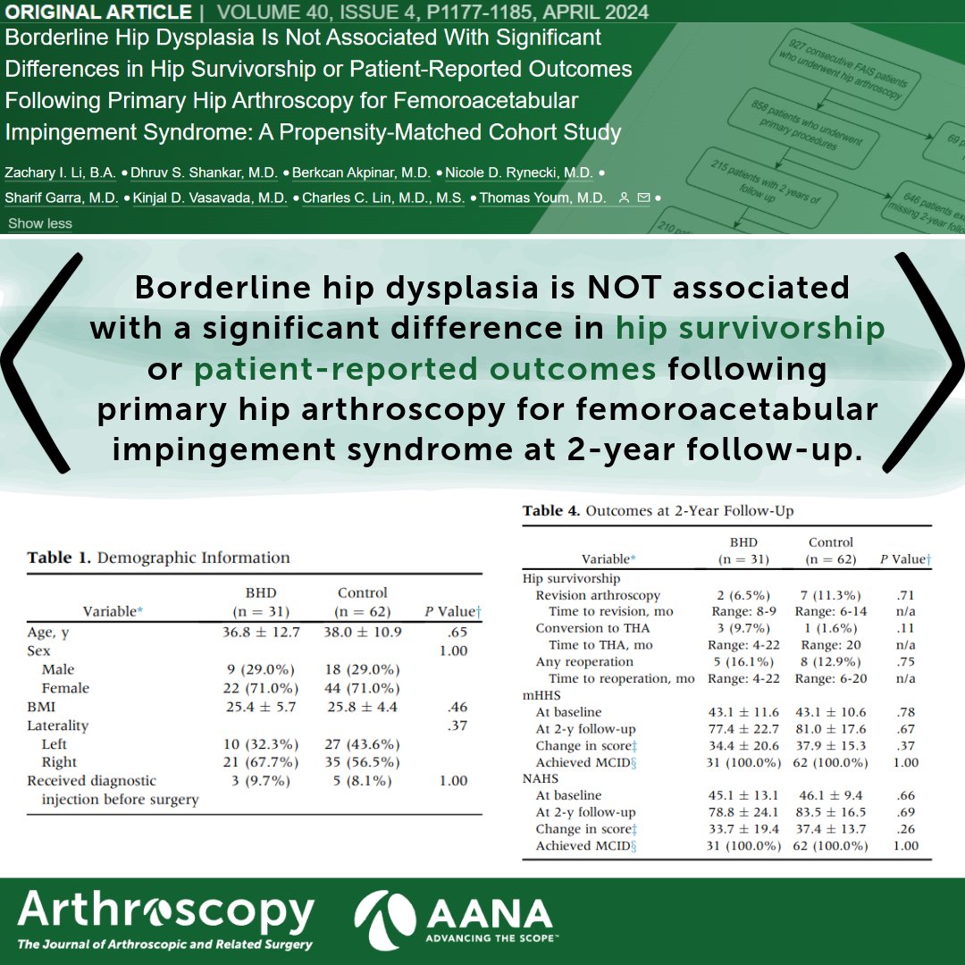 In this matched cohort study, borderline hip dysplasia is not associated with a difference in survivorship or patient-reported outcomes following primary hip arthroscopy for FAI. ow.ly/wNsf50RkvBC #hiparthroscopy #FAI #borderlinedysplasia