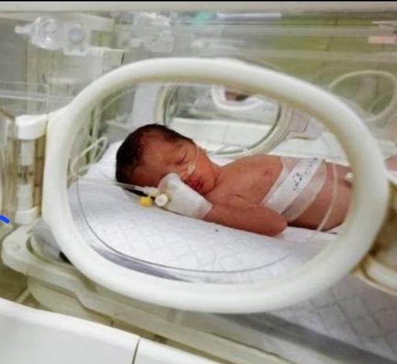 ElKemosahbee's tweet photo. @georgegalloway #Baby #Sabreen al-Sakani who was delivered by Caesarean section in a Rafah hospital on Sunday following the death of her mother in 🇮🇱 airstrike, has joined her mother. Inna Lillahi wa inna ilayhi raji'un. https://t.co/4wQGZBztki