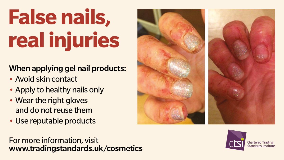 Staying on the topic of gel nail systems - these are the kind of adverse reactions that home users have experienced: 💅Nails lifting from the nail bed 💅Bleeding and sore skin 💅Sensitivity in the nails and fingers Follow #CostofBeauty ow.ly/9tQh50RoQ1Z