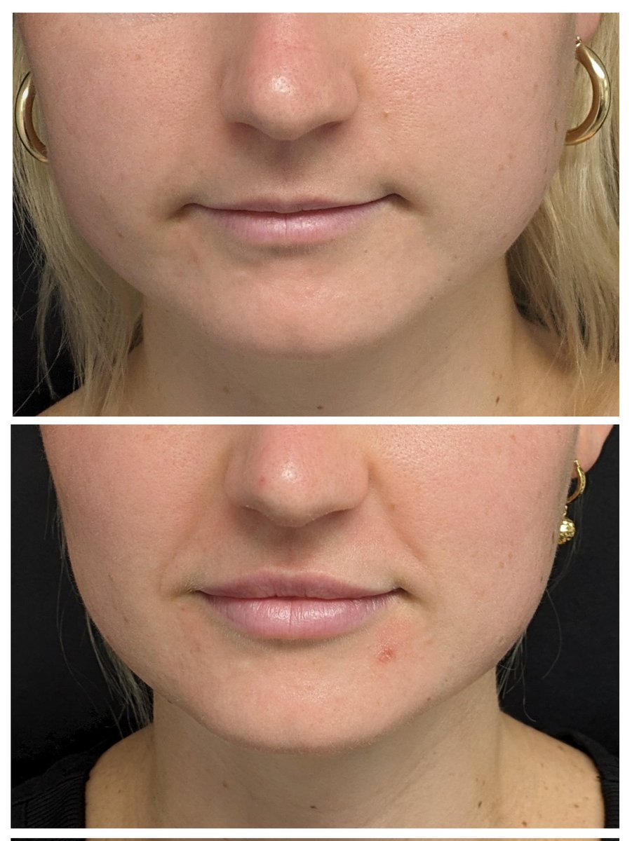 HighPointMedSpa tweet picture