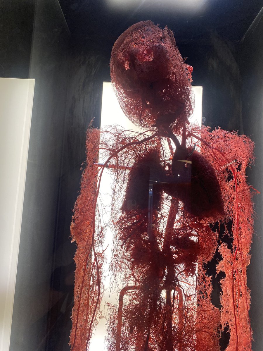 #angiogenesis #vascularbiology the arterial tree at Granada Science Center