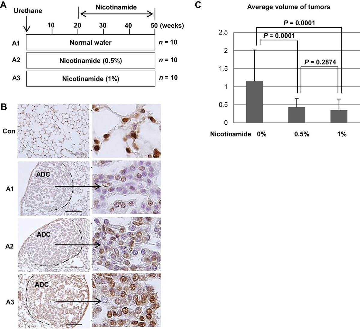 Phase 2b Study: Nicotinamide and EGFR-TKIs in EGFR-Mutated Adenocarcinoma. bit.ly/3QhfCiH