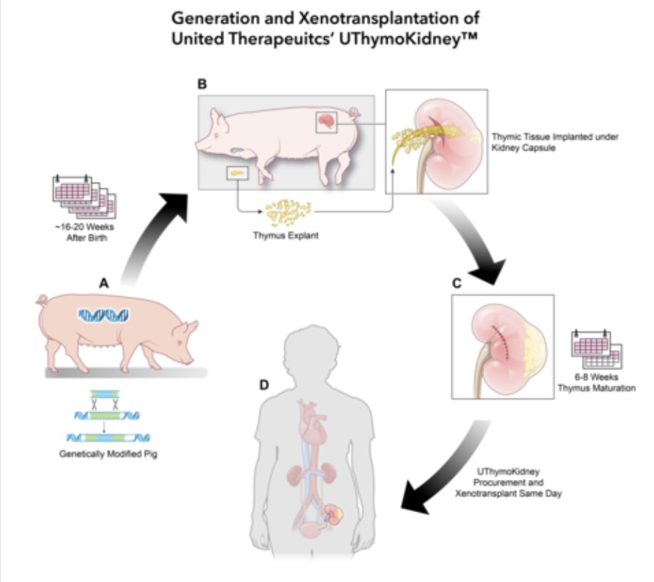 World's first successful transplant of a xenothymokidney (a pig kidney and simultaneous pig thymus fragments) into a living recipient, using organs from a genetically modified pig from United Therapeutics Corporation. #Xenotransplantation ir.unither.com/press-releases…