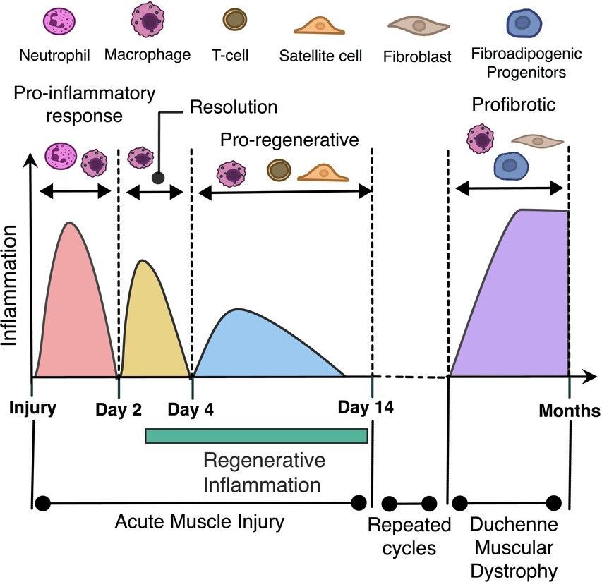 🏗️ Kicking off the weekend with a deep dive into regenerative inflammation! @LaszloNagyLab review how #macrophages help rebuild damaged tissues: 🏗️buff.ly/3w5UPYq #OpenAccess #RegenerativeBiology #ImmuneSystem
