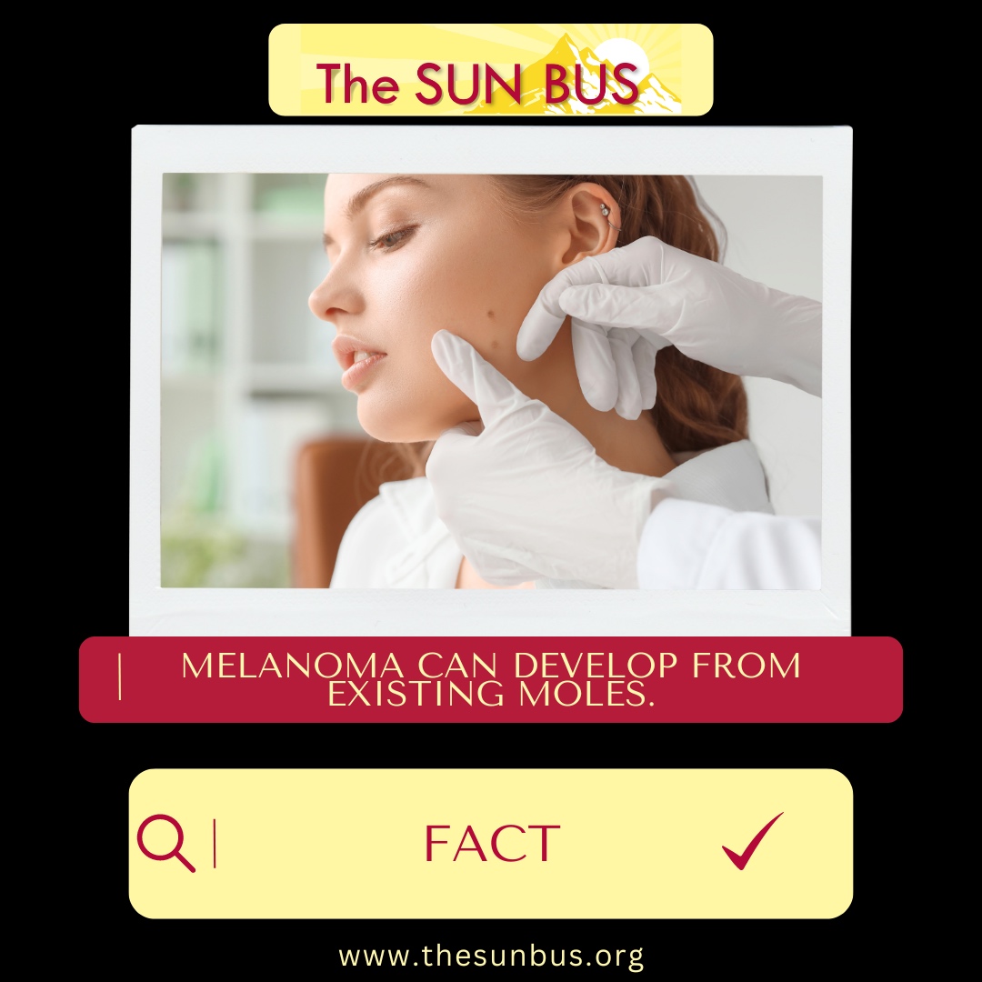 ☀️ Fact: Melanoma can develop from existing moles. Regularly monitor  🔍 your moles for any changes and don't hesitate to seek professional evaluation. Early detection is crucial for effective treatment! 🕵️‍♂️ #SkinHealth #MelanomaAwareness #FactOrFiction