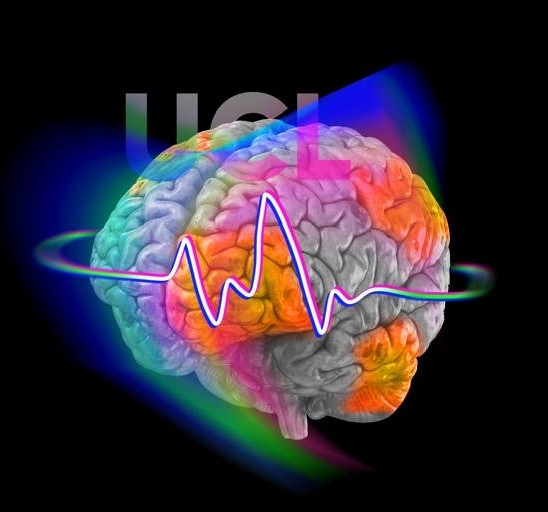 UCL Advanced Paediatric Neuroimaging Certificate Course. The UCL Great Ormond Street Institute of Child Health is proud to offer this unique course in Paediatric Neuroimaging. ucl.ac.uk/child-health/e… #Radiology #neuroscience #UCL #radiography #RadRes #USRad #IRad @drmankad