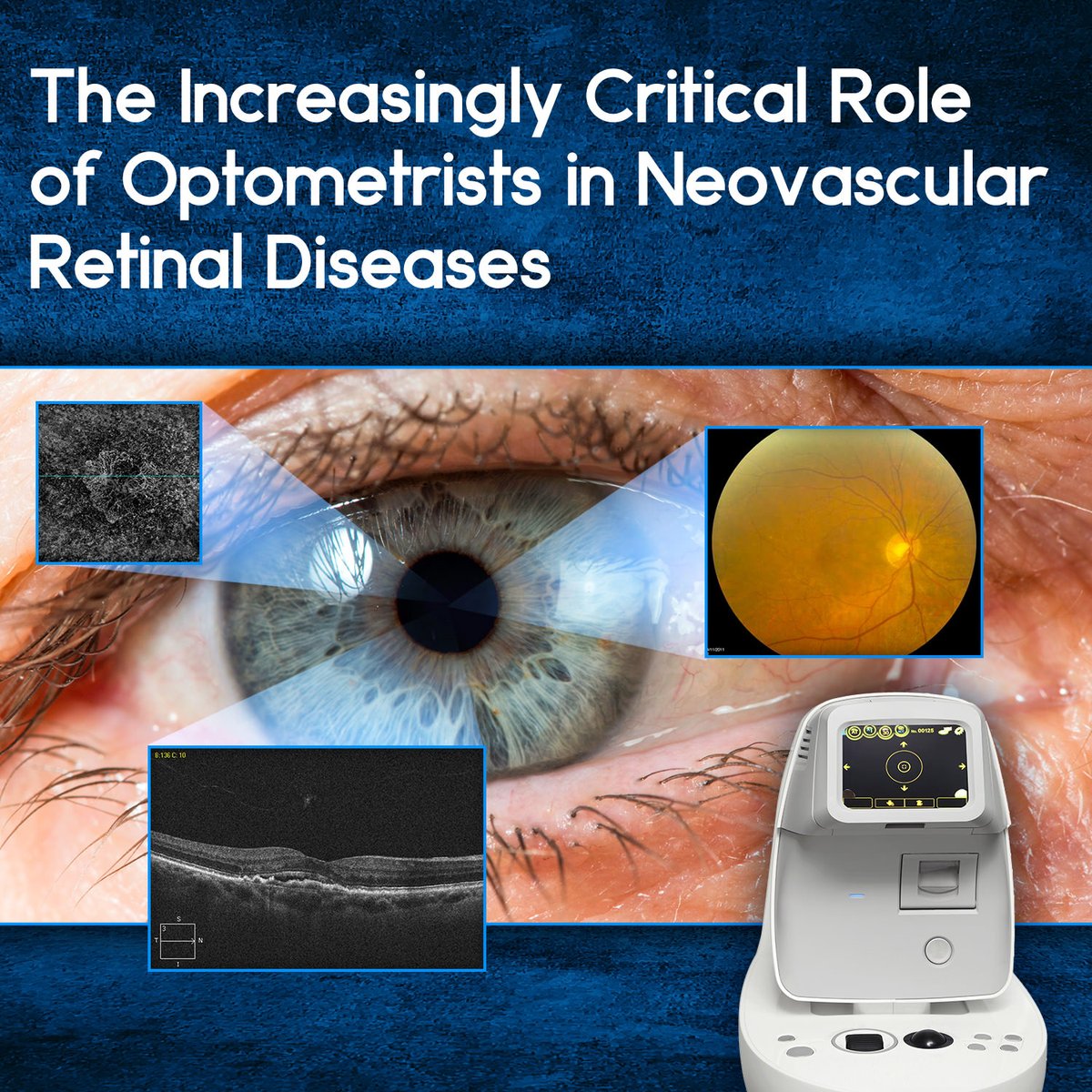 FREE CE: 'The Increasingly Critical Role of Optometrists in Neovascular Retinal Diseases'. 

Go to paradigmmc.com/1201 

#CME #CMEMedicalEducation #FREECE #ContinuingMedicalEducation #CEOptometry