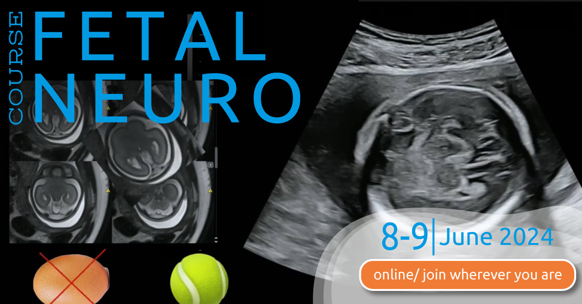 We're thrilled to share that our Fetal Neuro Course has earned EACCME accreditation! 🌟

📅 Dates: June 8-9, 2024
📍 Location: Online - Join from wherever you are!
🎓 Earn 13.5 European CME credits upon participation!
📺 Access to video recordings for 31 days!

Register now!