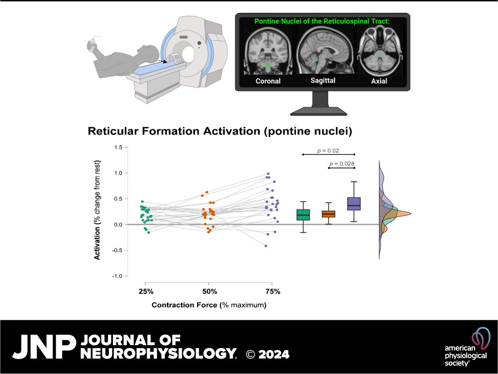 JNeurophysiol's tweet image. 📢New @JNeurophysiol Podcast ⚠️!

@JustinAndrushko highlights the  proposed hypotheses that the reticulospinal tract may play an important role in modulating force production in humans. 

🎧 Today! ow.ly/Z2ww50Rpab5
📃ow.ly/u0QP50Rpab3

#DescendingMotorPathways #fMRI