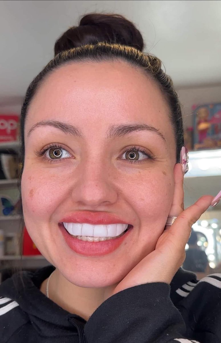 Cc te dicen que van a ir con otro Dr.  que le cobra más barato 👎🏼 big chale. 🤣🦷