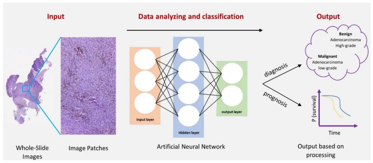 📝Today we share the #Review 'Deep Learning Approaches in Histopathology' 👏by Alhassan Ali Ahmed et al. @PUMS_tweets 🔗Lnk here: mdpi.com/2072-6694/14/2… Keywords: artificial intelligence; image analysis; deep learning
