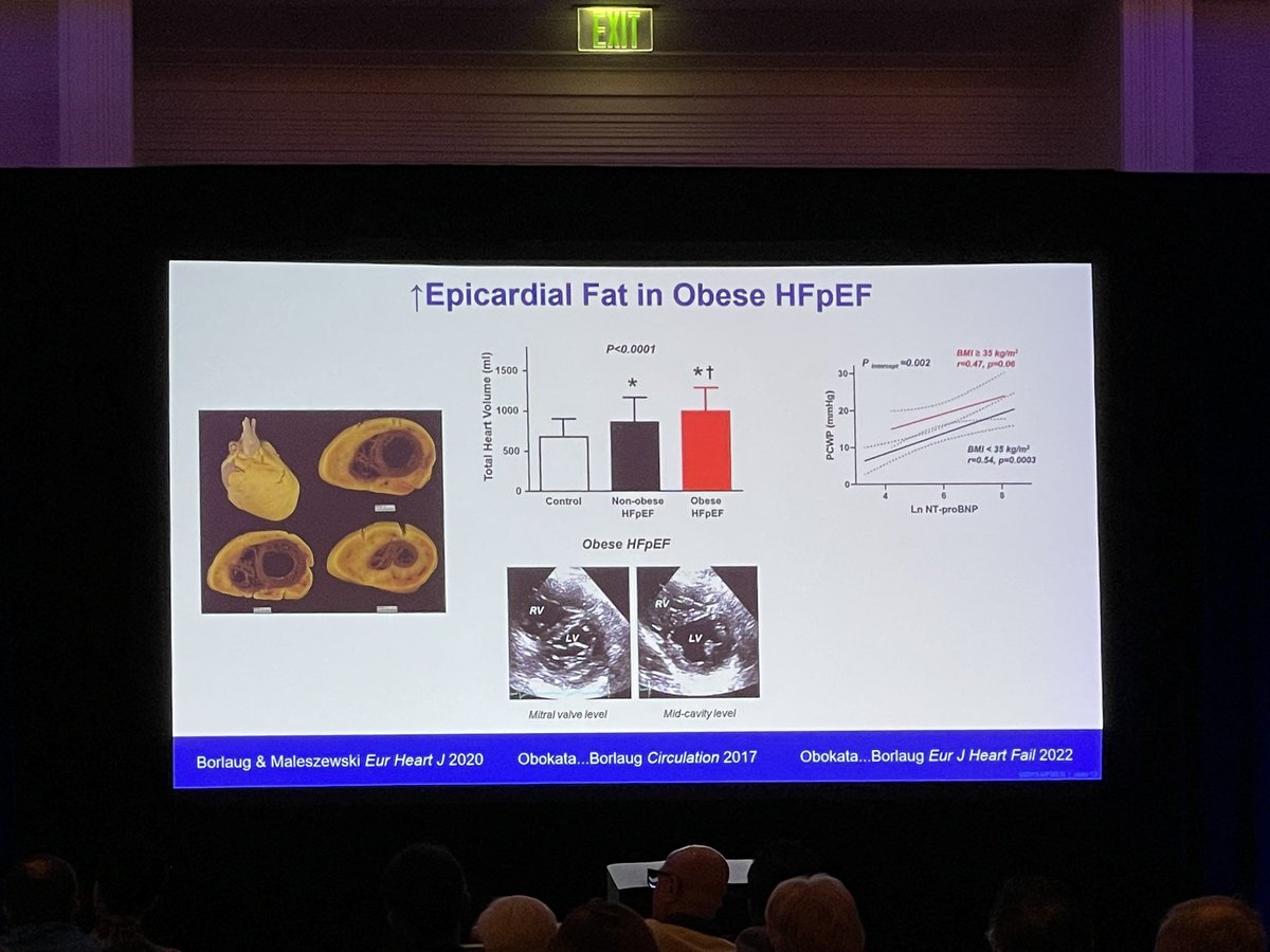 Here we go!! Kicking off #ScrippsHF_EP2024 with #HFpEF, device/procedural based therapies, and what to know in special populations obesity and women @jtheywood @RajeevCMohan Dr. Barry Borlaug