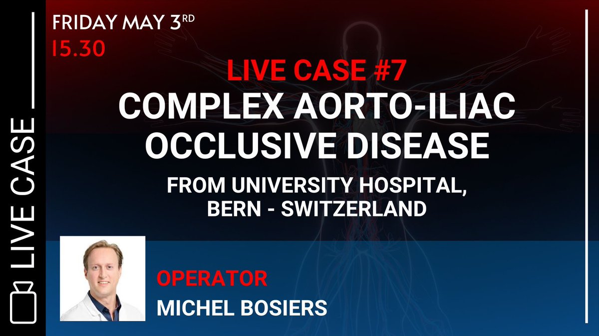 Don’t miss the Live case 7 from University Hospital, Bern 🇨🇭 on May 3rd at 15.30 AM!

Michel Bosiers will perform this case on “Complex Aorto-iliac occlusive disease” and share with you his expertise.

 Still on time to grab your spot ➡ swll.to/register-MLEND…

#MLCTOENDO2024