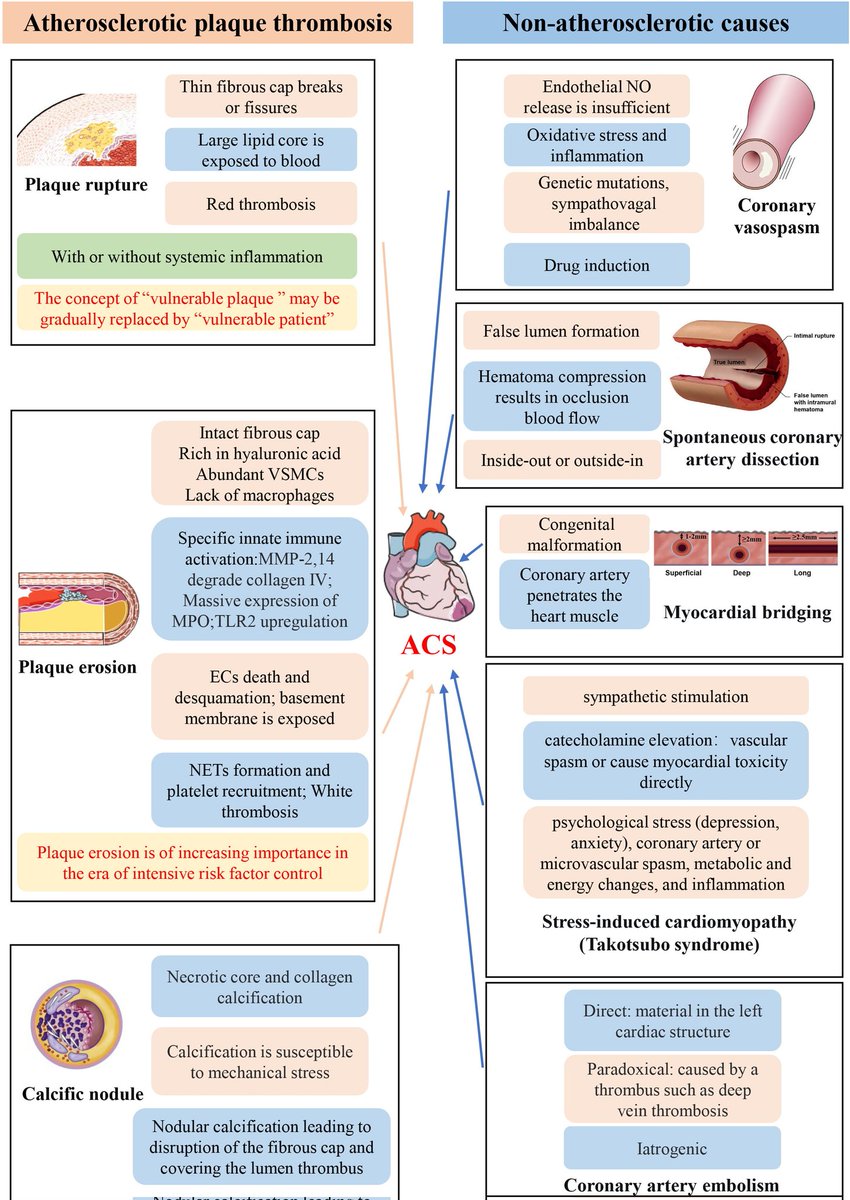 🔴New Concepts on the Pathophysiology of Acute Coronary Syndrome #OpenAccess #Review

imrpress.com/journal/RCM/24…
 #CardioEd #Cardiology #echofirst #POCUS #ENARM #MedTwitter #CardioTwitter #ACC2024 #CardioEd #Cardiology #FOAMed #meded #MedEd #Cardiology #CardioTwitter #cardiotwitter