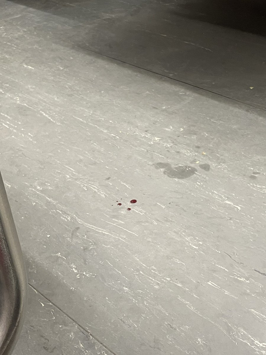 trying to predict when this blood on the subway was dropped by how fast it’s dried from runnymede to dufferin