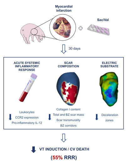 Victoria Delgado (@vdelgadogarcia) on Twitter photo Are you aware of the antiarrhythmic and anti-inflammatory effects of sacubitril/valsartan on post-MI scar? check out the article of Daina Martinez-Falguera in <a href="/CirculationEP/">CircEP</a> 👉ahajournals.org/doi/10.1161/CI… @IcorCat <a href="/GTRecerca/">IGTP</a> <a href="/santi_roura/">Santi Roura</a> <a href="/GalvezMonton/">Carol Galvez-Monton</a> <a href="/bisbal_EP/">Felipe Bisbal</a> <a href="/oriolrodriguez5/">Oriol Rodriguez</a> Are you aware of the antiarrhythmic and anti-inflammatory effects of sacubitril/valsartan on post-MI scar? check out the article of Daina Martinez-Falguera in <a href="/CirculationEP/">CircEP</a> 👉ahajournals.org/doi/10.1161/CI… @IcorCat <a href="/GTRecerca/">IGTP</a> <a href="/santi_roura/">Santi Roura</a> <a href="/GalvezMonton/">Carol Galvez-Monton</a> <a href="/bisbal_EP/">Felipe Bisbal</a> <a href="/oriolrodriguez5/">Oriol Rodriguez</a>