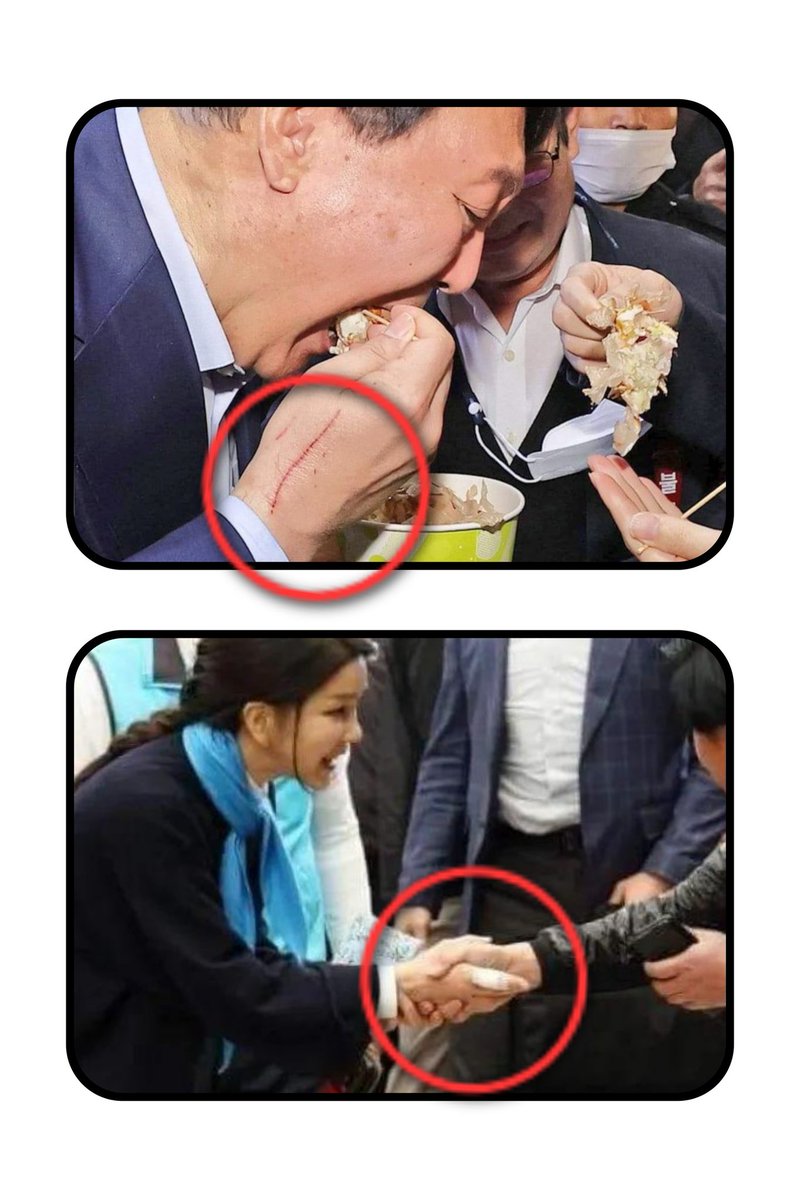 Mohaniiiiii's tweet photo. 이 부부...
손에  큰 상처 입는 이유가 뭘까요? https://t.co/LObwXUGxpE